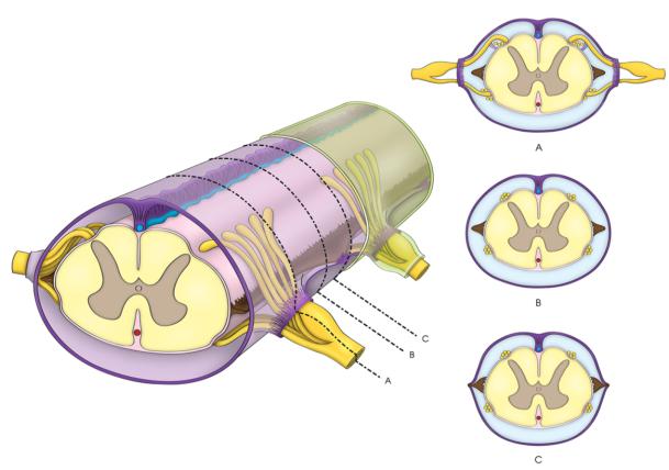 了解脊髓蛛网膜池的解剖有助于脊髓手术