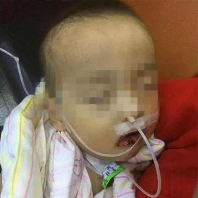 「干燥剂」妈妈愚蠢做法险些害了孩子，老爸成功挽救3岁孩子误食干燥剂