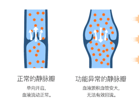 长时间站着、坐着，当心双腿惨不忍睹！32岁小伙小腿都“花”了