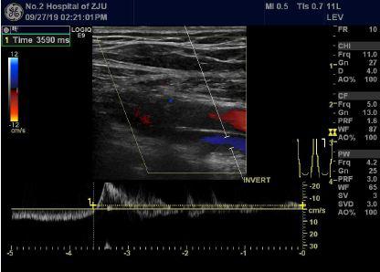 长时间站着、坐着，当心双腿惨不忍睹！32岁小伙小腿都“花”了
