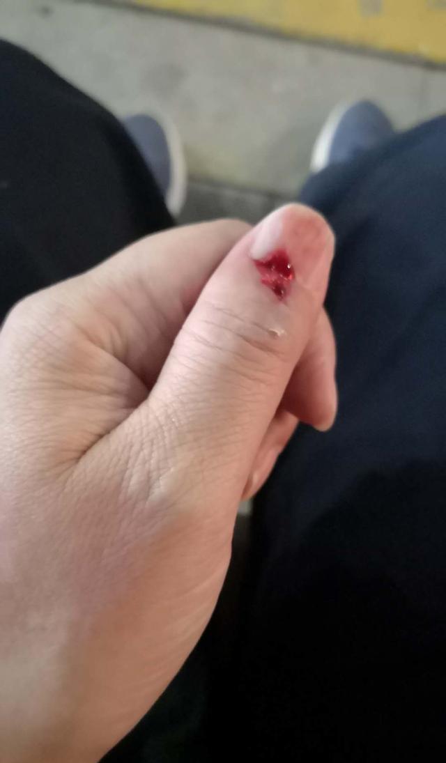 受伤时