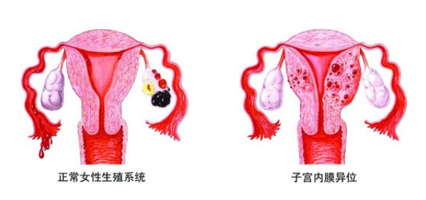 吃什么可以快速补孕酮 e53e4738076249eab42782d4d67ebbfa.png