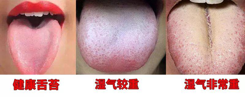 湿气重的人,  舌苔往往又厚又腻,早上醒来还会  口苦口臭!