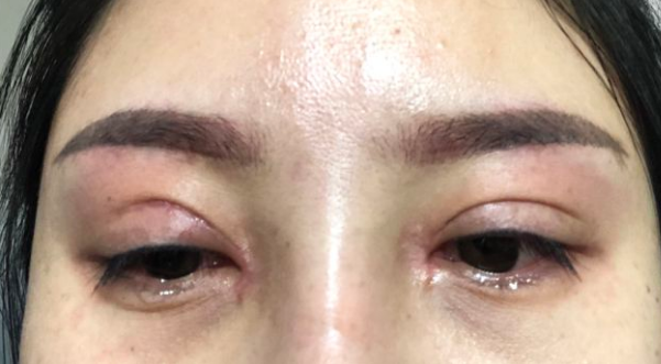 医院检查视力花费多少 66385f06923e4e7db2381fefb2e17401.png