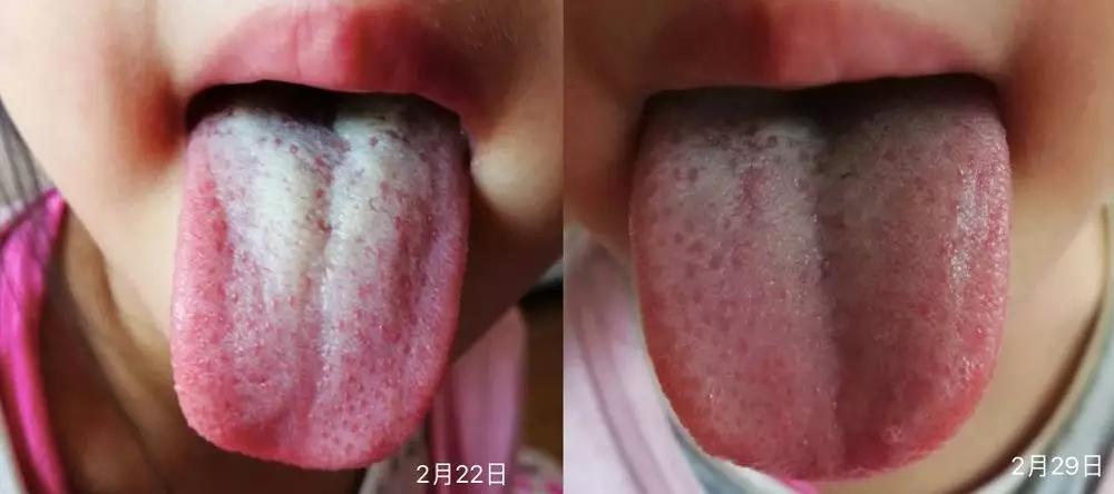 「孩子」孩子不生病是小儿推拿的功劳-丹凤贝乐佳小儿推拿我怎么能知道