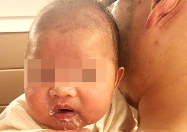 「宝宝」大多会有这5个常见问题，新手妈妈早知道早放心新生儿出生后