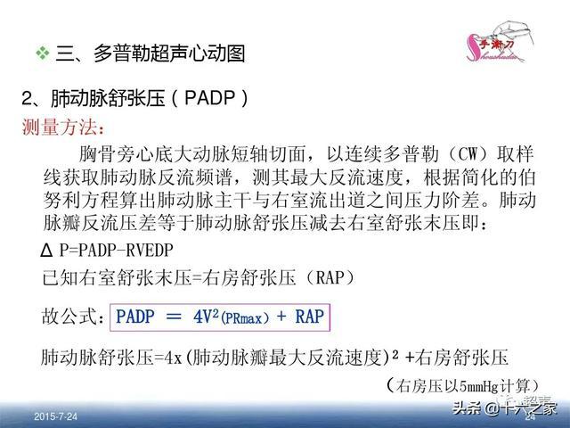肺动脉高压的超声评估方法