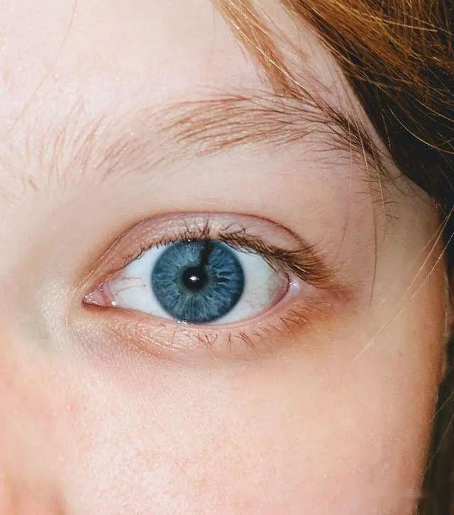 19张活久未见的"基因"照,冰蓝色的眼睛,难以梳理的头发综合症