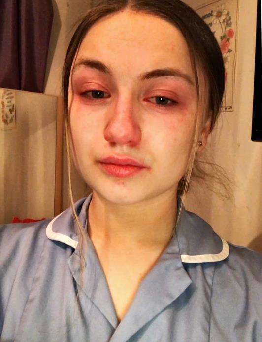 英国护士工作13小时哭红双眼 含泪告诫:待在家里是一种特权