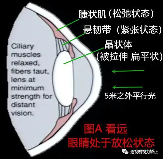 先看下图a和图b,晶状体扁平状和球状,晶状体是凸透镜,对光线有汇聚