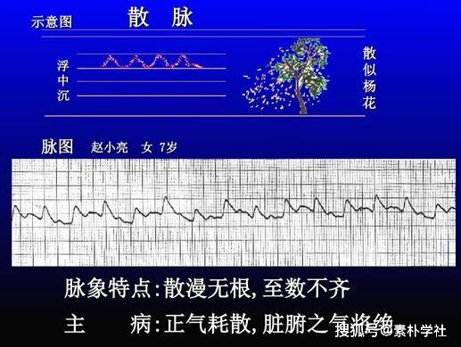 脉诊的核心部分正常脉象与病理脉象各是什么触感