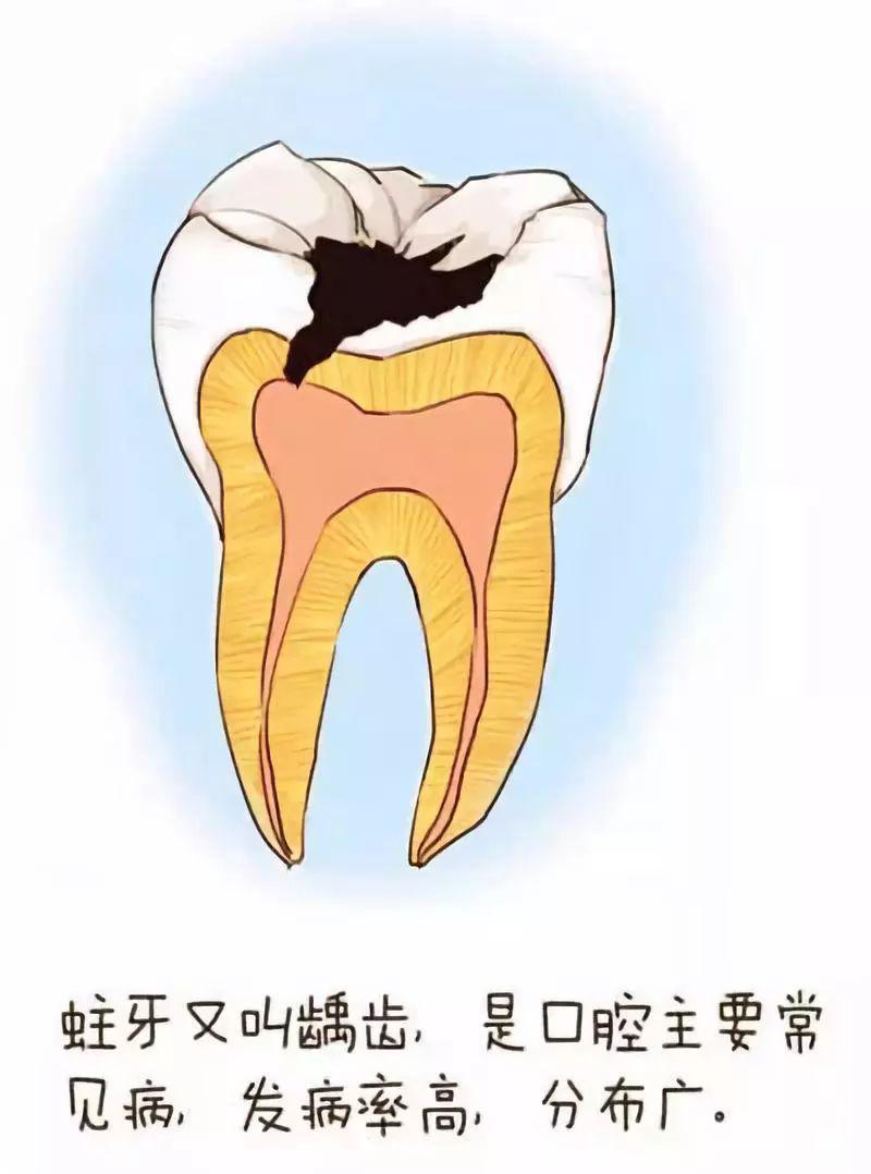 【临床科普】牙齿是怎么坏掉的?漫画版