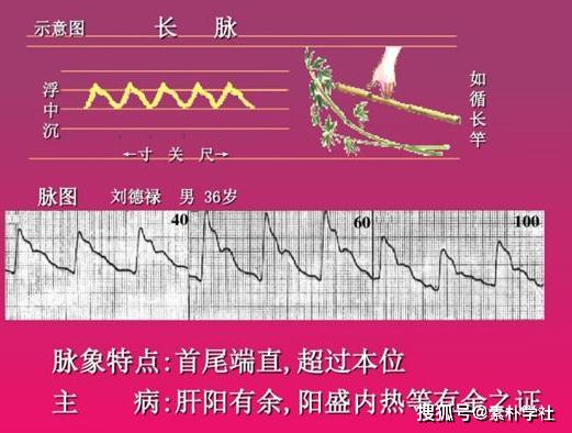 脉诊的核心部分:正常脉象与病理脉象各是什么触感?