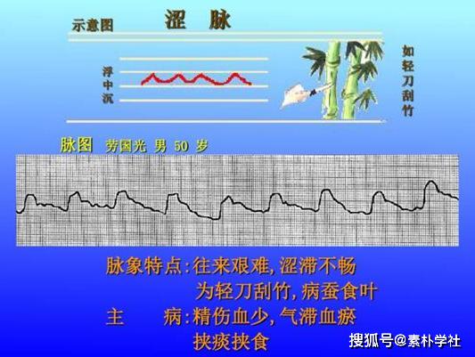 脉诊的核心部分正常脉象与病理脉象各是什么触感