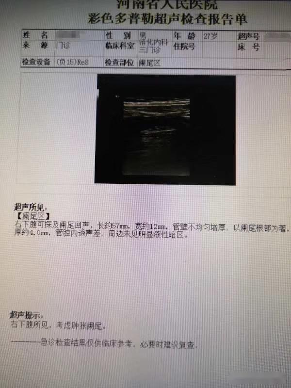 患者捂着肚子说胃痛专家却给开了检查阑尾的单子