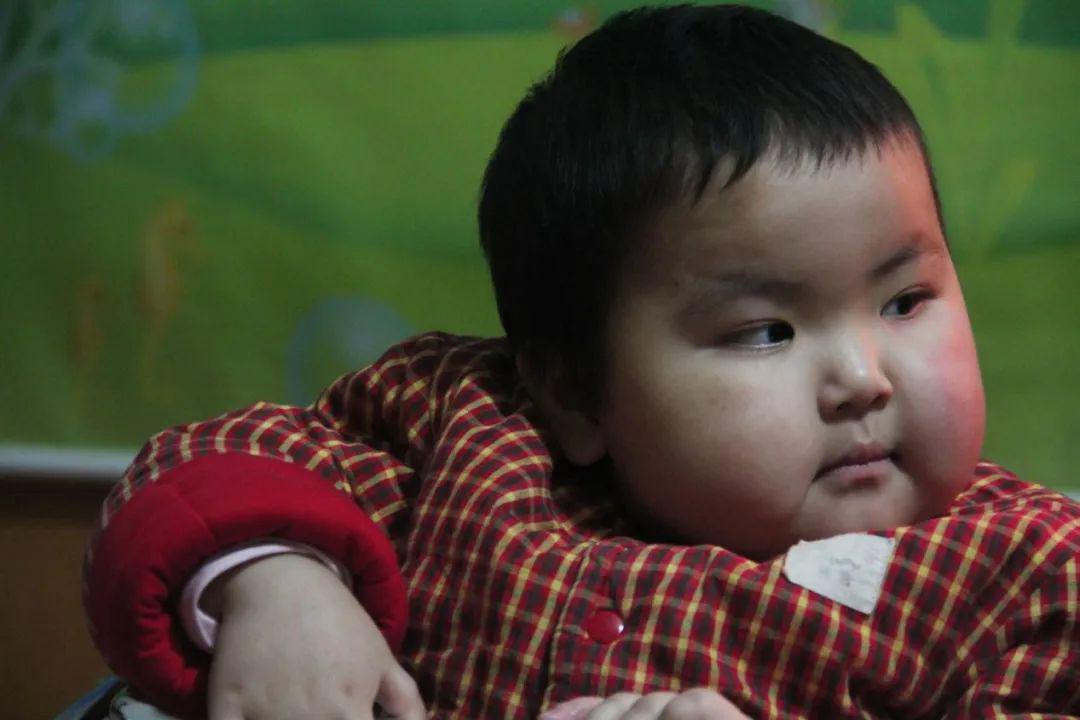 [夫妻]三岁女孩患上罕见病 90后夫妻两千块卖掉婚戒筹药费