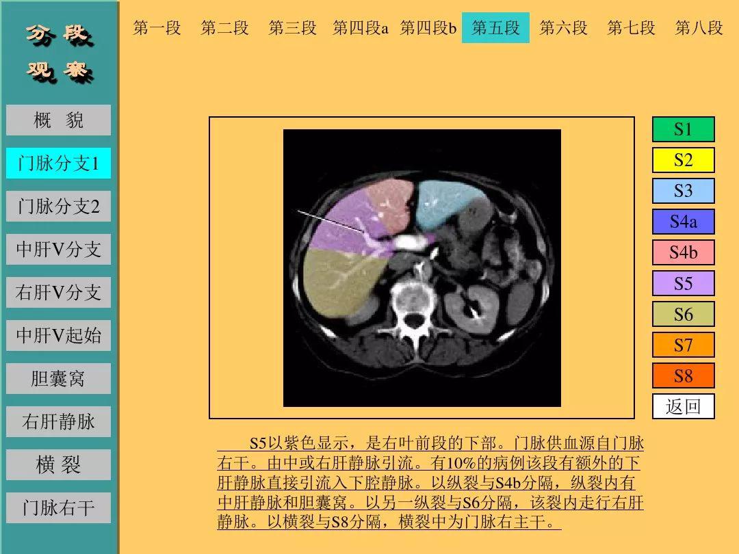 点击收藏肝脏的ct断层解剖详解