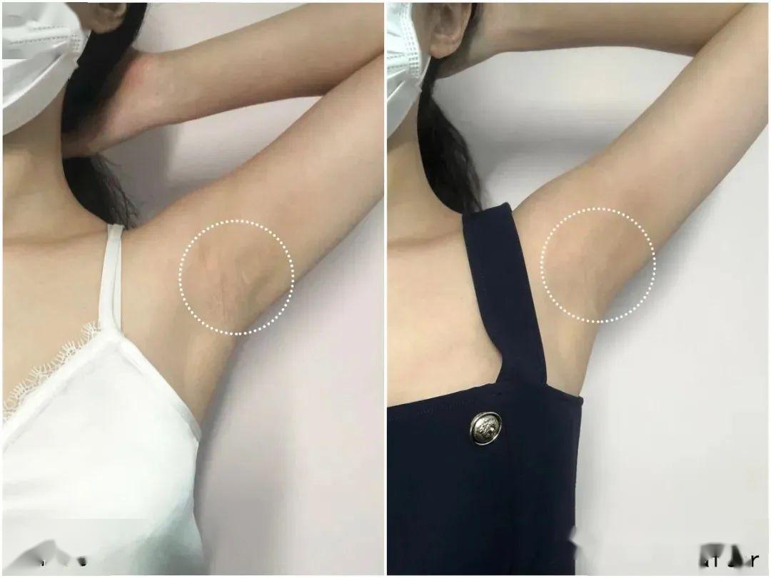 推广||买了那么多新衣服，这笔小钱更不能省！