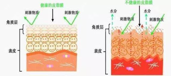 随着年龄的增长,由于皮肤萎缩,皮下脂肪减少,弹性纤维断裂,上皮组织