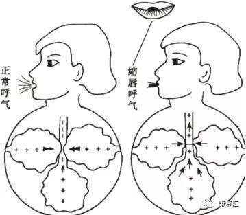 增加气道阻力, 减轻/防止小气道过早闭合(1)缩唇呼吸(pus p b eat g)