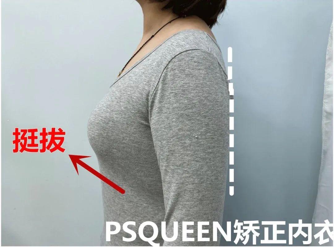 乳房下垂自测：女性从20岁起出现中度下垂…… - 知乎