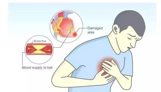 几个月出现一次胸口疼是怎么回事 9dfc64b3d51d4161a45dd22c0b9f0985.jpeg