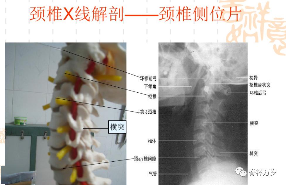 影像学四颈椎侧位片的阅片顺序