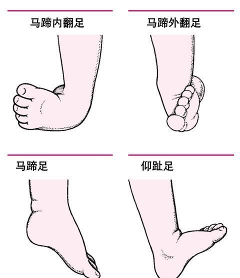 几个月可以查出来孩子畸形 8934667ebcc14548b2a0bb7b2b541526.jpeg