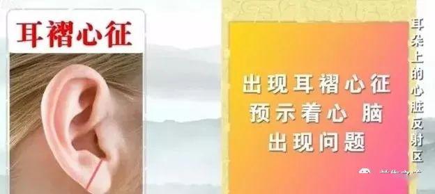 耳朵上出现这条沟当心是冠心病的信号胸闷气短者多注意
