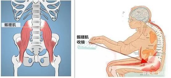 中药及推拿治疗腰肌劳损