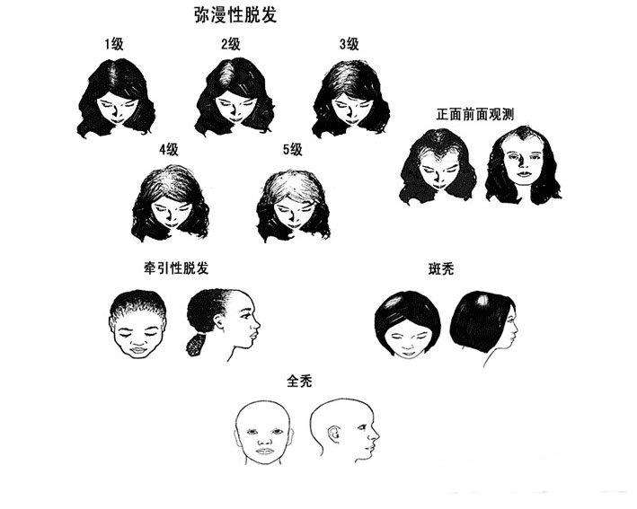 头发的生长,而生长激素的缺乏则会使头发的生长速度相对变慢……所以
