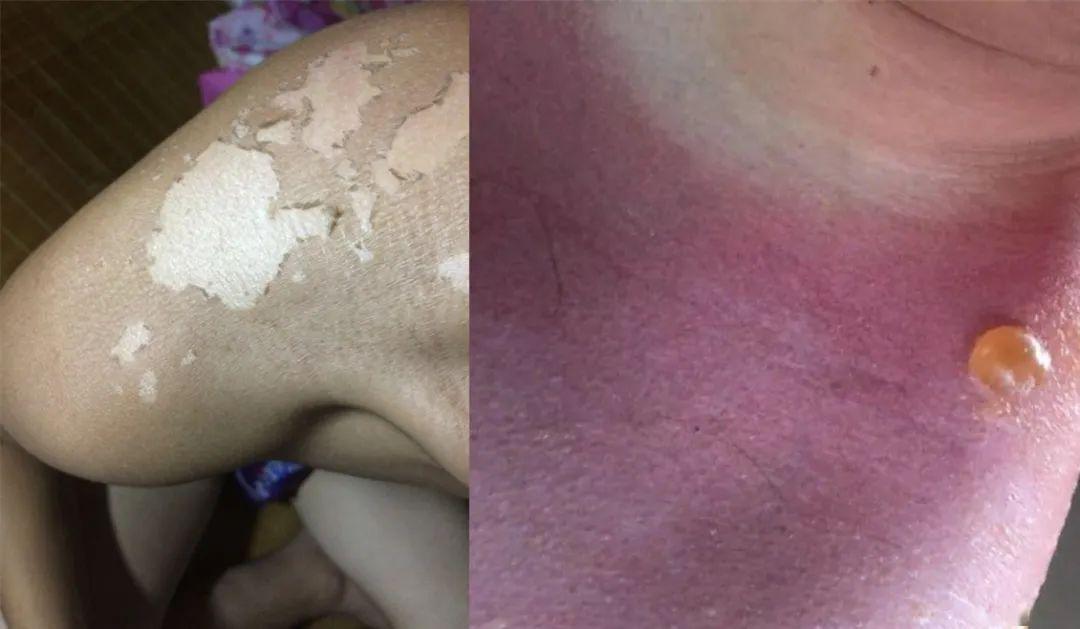 李佳琦吹爆的泰国明星防晒!能防晒、驱蚊、美白,随时补喷! 李佳琦吹爆的泰国明星防晒!能防晒、驱蚊、美白,随时补喷!