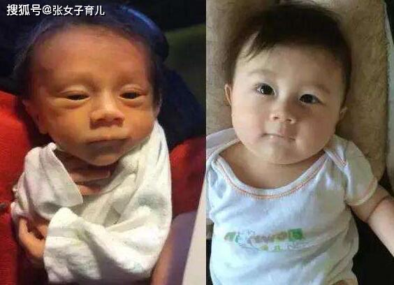 #丑死#为什么漂亮宝宝都是别人家的？我家宝宝出生时丑死了