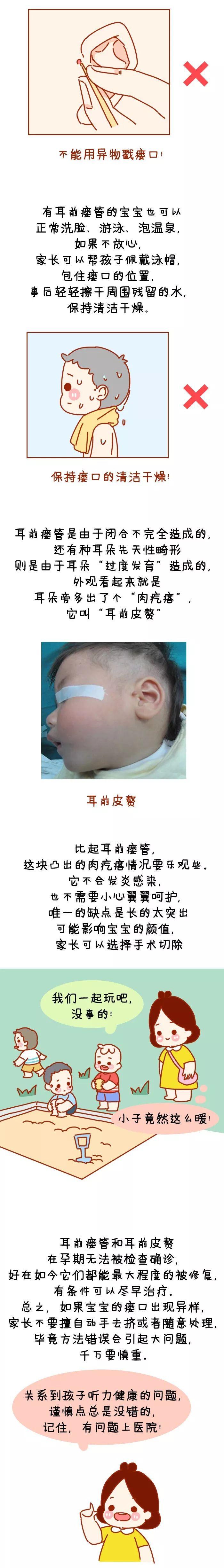 小孔：这可不是什么“富贵仓”！耳朵上有这个小孔的宝宝注意了