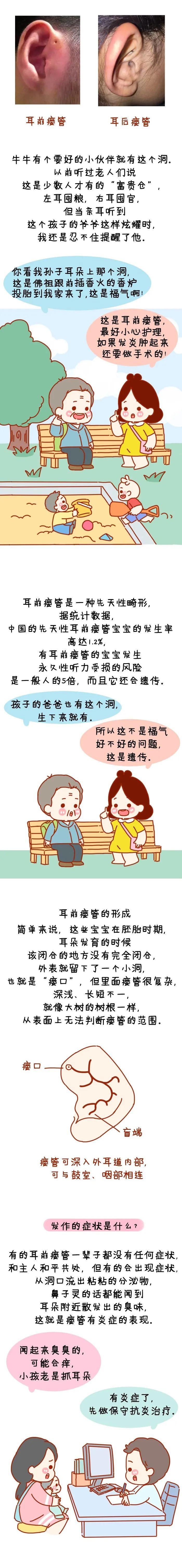 小孔：这可不是什么“富贵仓”！耳朵上有这个小孔的宝宝注意了