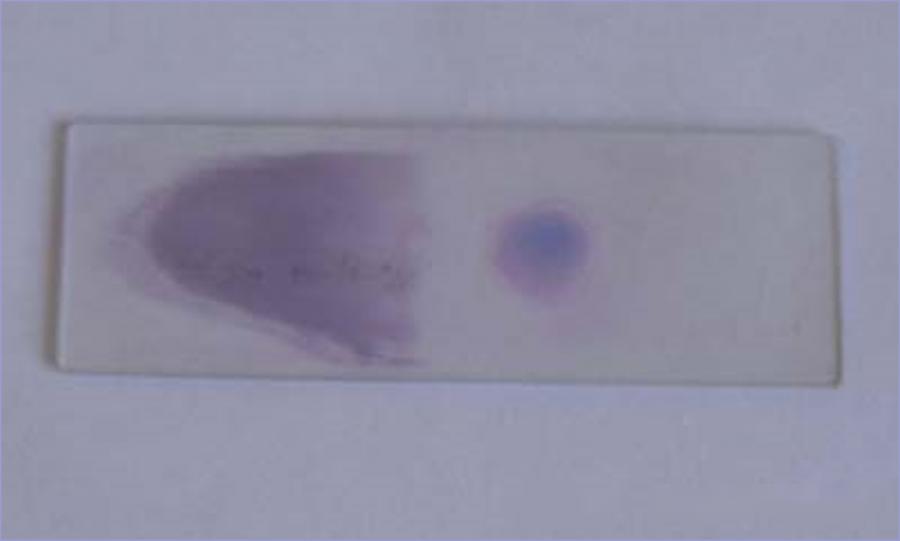 厚血膜疟原虫形态