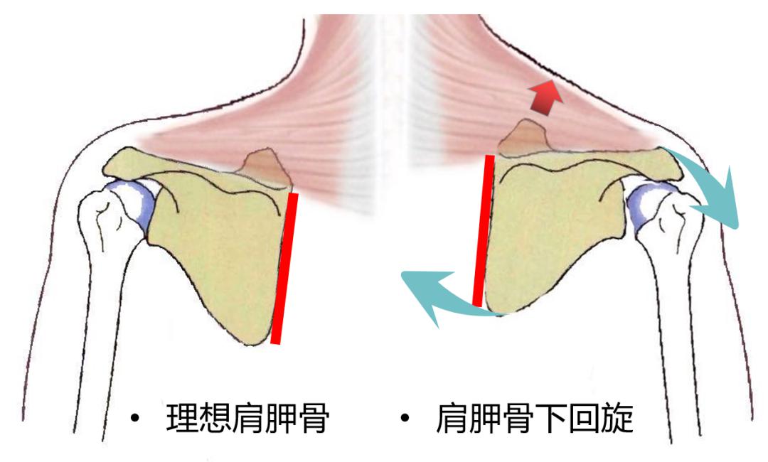 体态大师为什么肩膀下沉肩胛骨后缩夹紧会增大斜方肌