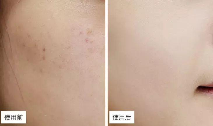 色素的搭配 8dce1891ade74af8a9f8ad0837f4c2e8.jpeg