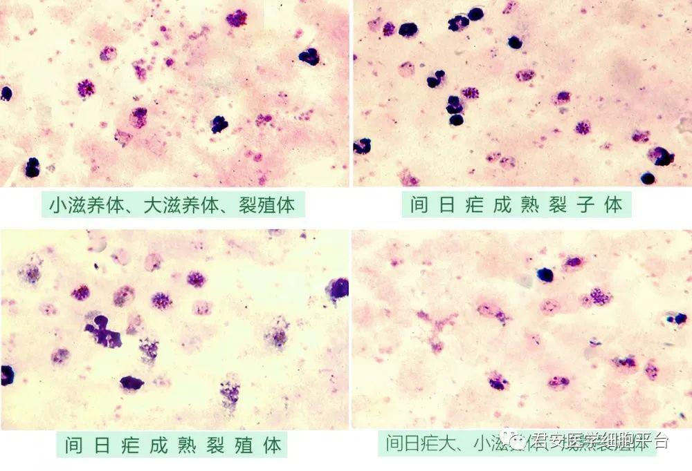 厚血膜疟原虫形态