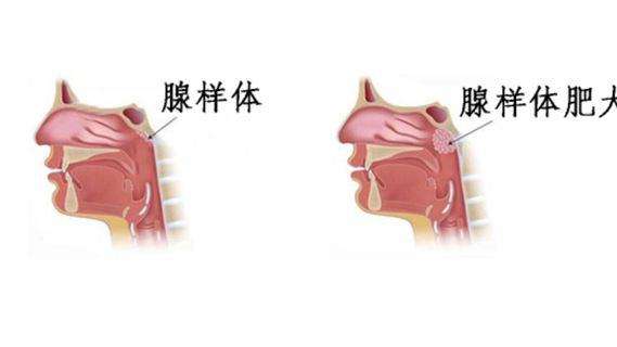 什么手术可以让嘴变大 c10801e7ab1a4f91b4a6b64f2a71d75c.jpeg