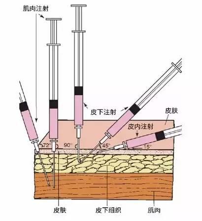 【护考重点】皮内?皮下?肌肉?注射有啥区别