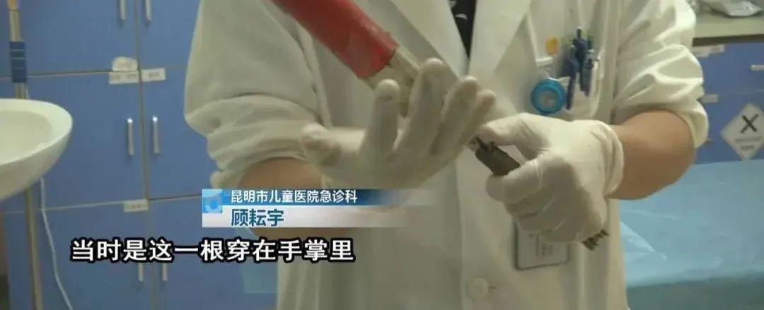 『手掌』云南 | 疼!6岁孩子爬上电杆不慎滑落!左手手掌被钢丝刺穿!