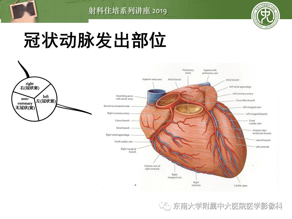 中大放射住培系列讲座冠状动脉cta诊断流程