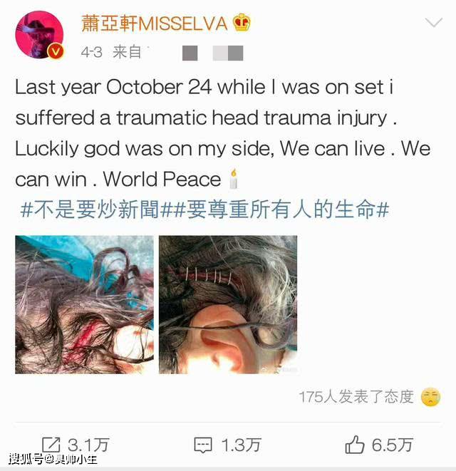 受伤缝针视频 f0d07a9aec504cab9053497877e84e27.jpeg