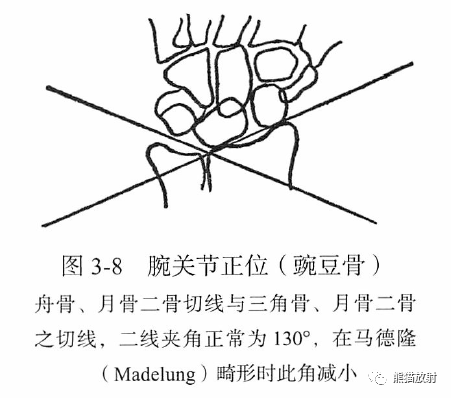 骨关节丨画线及测量