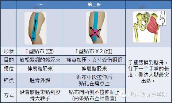 奔跑吧,髂胫束!