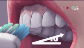 如何刷牙才是正确的图解 6c6750ed643d4bc28bf354b9f524c7b8.gif