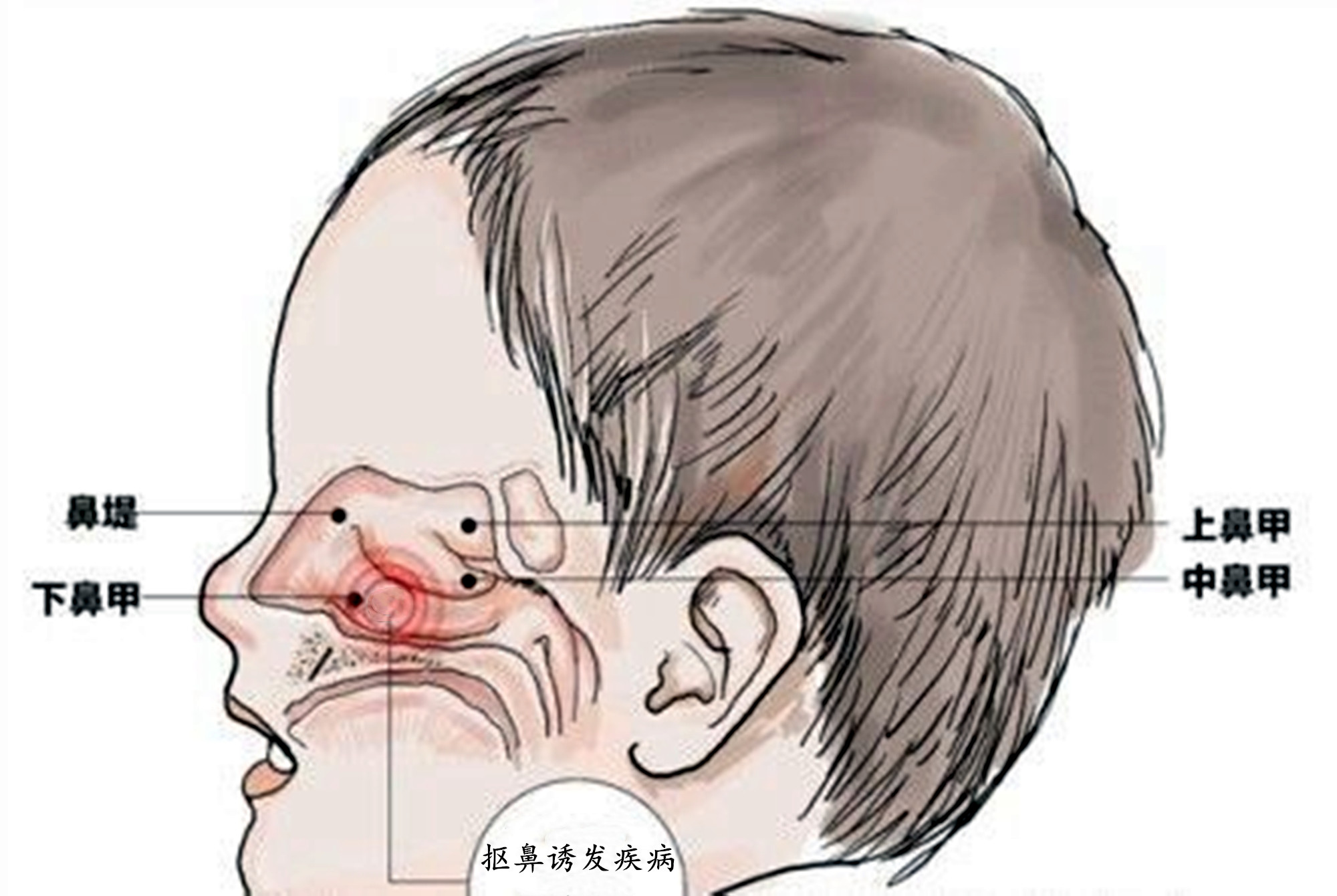 医生:有两种危害等着_鼻腔