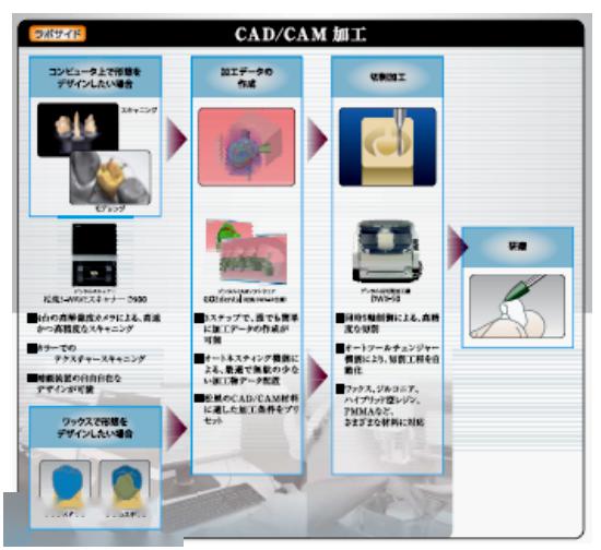 shofu ceramage 聚合瓷,灿烂的笑容来自松风