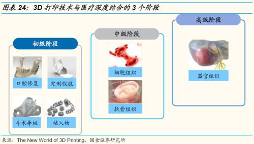 国金证券：运动普天博tb综合体育及人口老龄化、医疗科技发展助运动医学方兴未艾(图19)